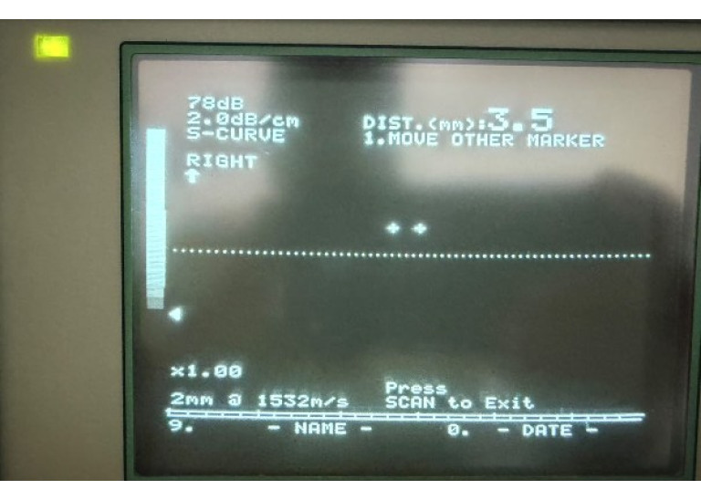 Sonomed B-Scan B-5500